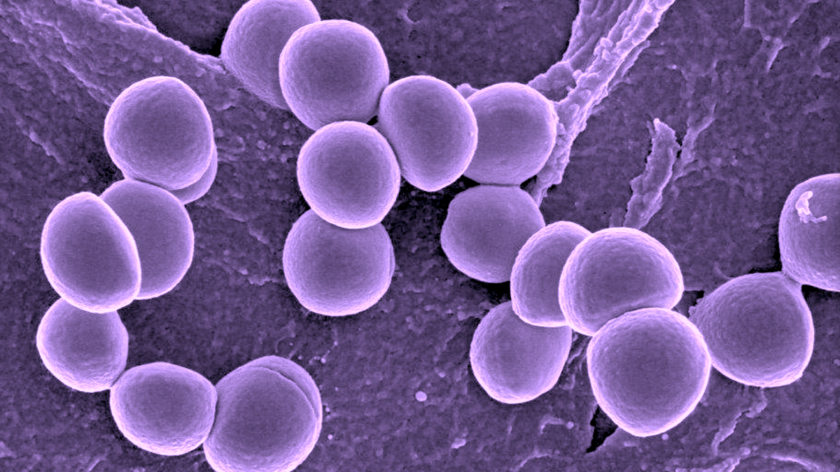 Staphylococcus aureus