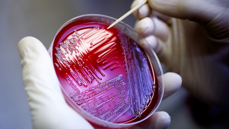 A Nebraska researcher transfers E. coli from gar plates growing cultures for analysis. Links to larger image.