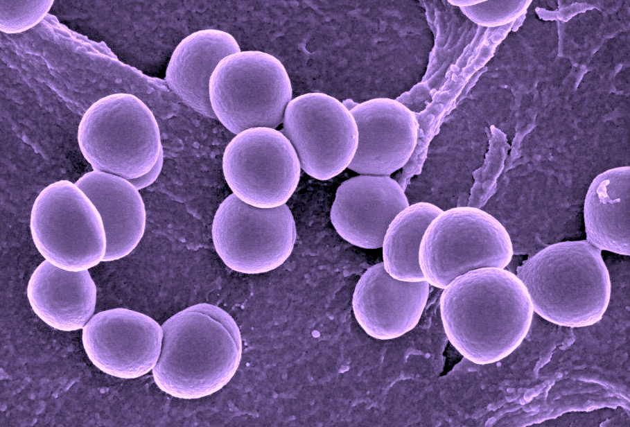 Staphylococcus aureus