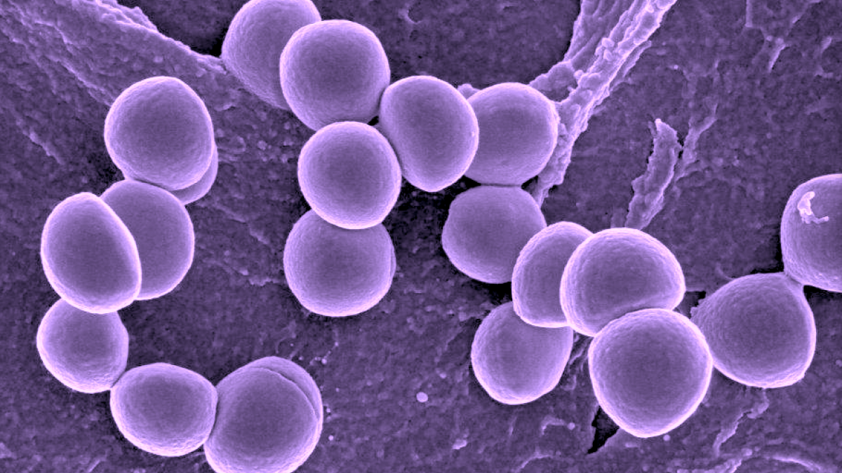 Staphylococcus Aureus: What It Is & Treating It
